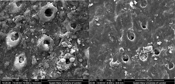 tubules after acid lo res