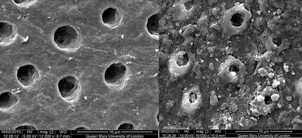 tubules micrograph lo res